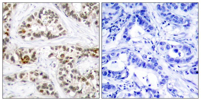 RelB (Phospho-Ser573) Rabbit Polyclonal Antibody, 100 ug