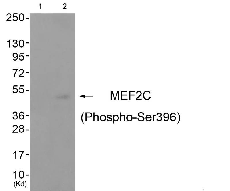 MEF2C (Phospho-Ser396) Rabbit Polyclonal Antibody, 100 ug