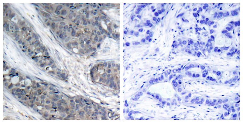 IRS-1(Phospho-Ser307) Rabbit Polyclonal Antibody, 100 ug