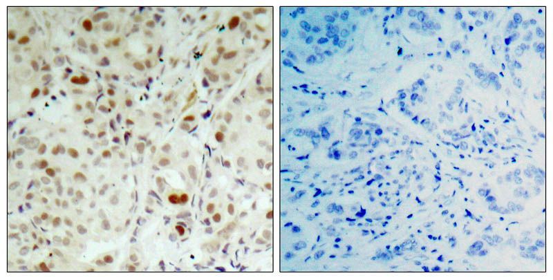 Rb (Phospho-Ser807) Rabbit Polyclonal Antibody, 100 ug