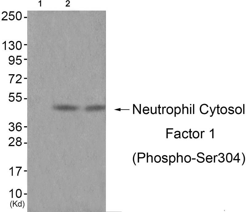 Neutrophil Cytosol Factor 1 (Phospho-Ser304) Rabbit Polyclonal Antibody, 100 ug