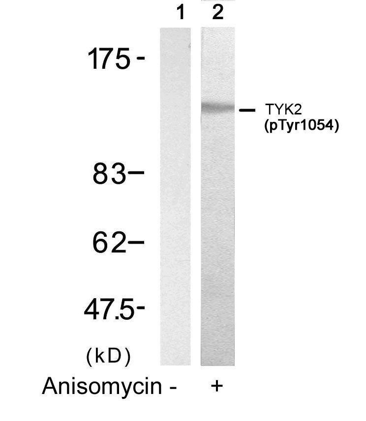 TYK2 (Phospho-Tyr1054) Rabbit Polyclonal Antibody, 100 ug