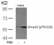 Smad2 (Phospho-Thr220) Rabbit Polyclonal Antibody, 100 ug