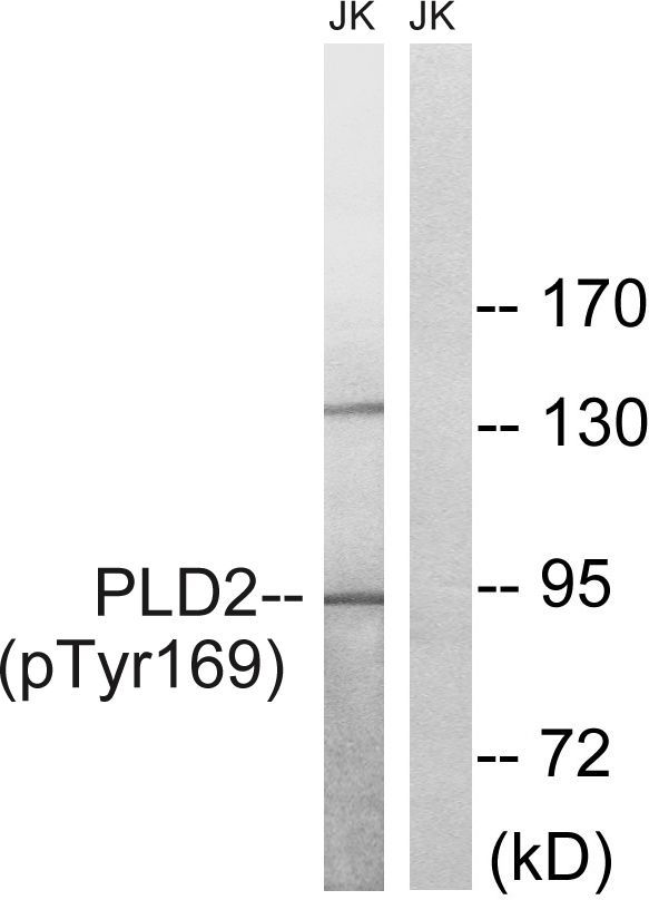 PLD2 (Phospho-Tyr169) Rabbit Polyclonal Antibody, 100 ug
