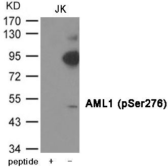 AML1 (Phospho-Ser276) Rabbit Polyclonal Antibody, 100 ug
