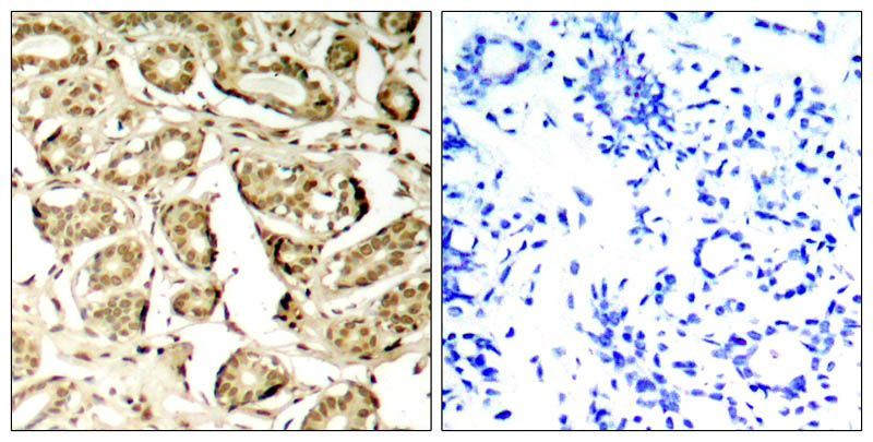 MEF2A (Phospho-Ser408) Rabbit Polyclonal Antibody, 100 ug