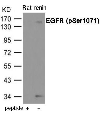 EGFR (Phospho-Ser1071) Rabbit Polyclonal Antibody, 100 ug