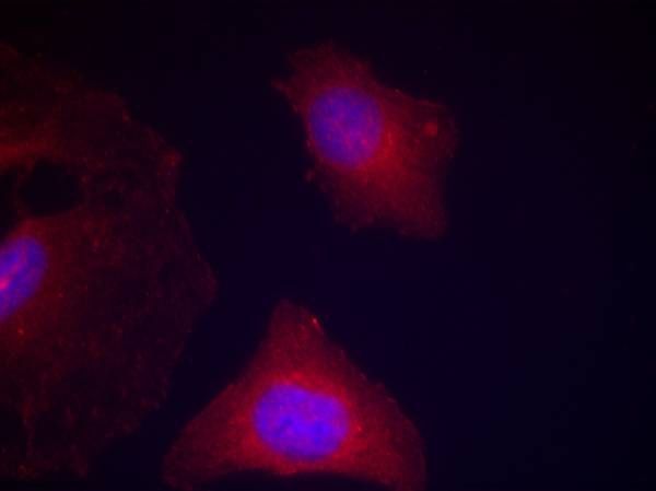 GSK3α/β(Phospho-Tyr279/216) Rabbit Polyclonal Antibody, 100 ug