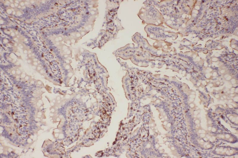EGFR (Phospho-Thr678) Rabbit Polyclonal Antibody, 100 ug