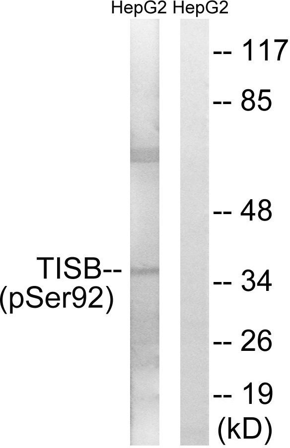 Nuclear Receptor NR4A1 (Phospho-Ser351) Rabbit Polyclonal Antibody, 100 ug
