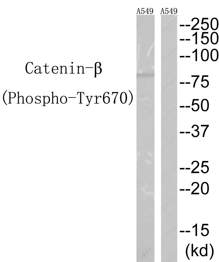 Catenin-β(Phospho-Tyr670) Rabbit Polyclonal Antibody, 100 ug