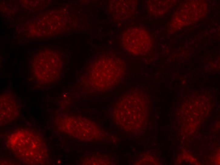PKCβ (Phospho-Thr641) Rabbit Polyclonal Antibody, 100 ug
