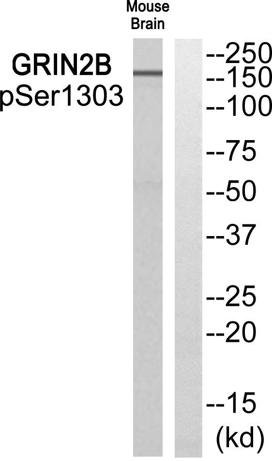 GRIN2B (Phospho-Ser1303) Rabbit Polyclonal Antibody, 100 ug
