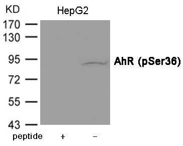 AhR (Phospho-Ser36) Rabbit Polyclonal Antibody, 100 ug