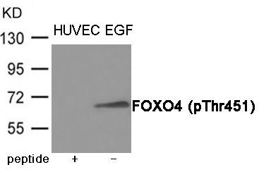 FOXO4 (Phospho-Thr451) Rabbit Polyclonal Antibody, 100 ug