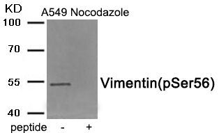 Vimentin (Phospho-Ser56) Rabbit Polyclonal Antibody, 100 ug