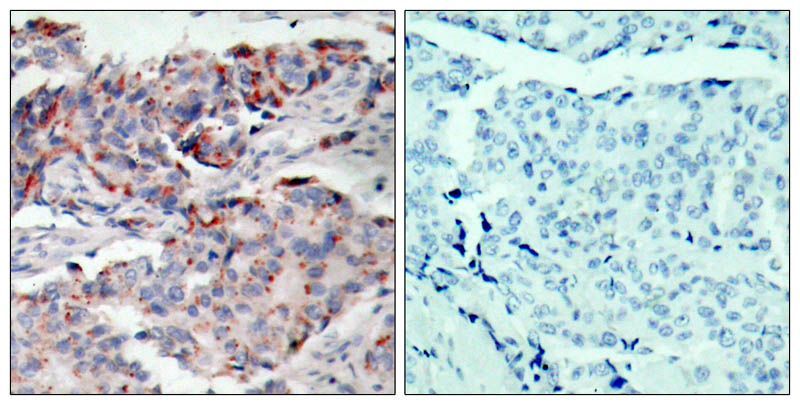 JAK2(Phospho-Tyr221) Rabbit Polyclonal Antibody, 100 ug