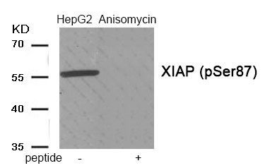 XIAP (Phospho-Ser87) Rabbit Polyclonal Antibody, 100 ug XIAP (Phospho-Ser87) Rabbit Polyclonal Antibody, 100 ug