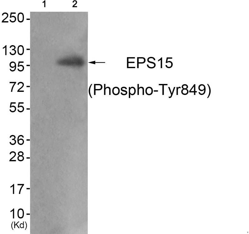 EPS15 (Phospho-Tyr849) Rabbit Polyclonal Antibody, 100 ug