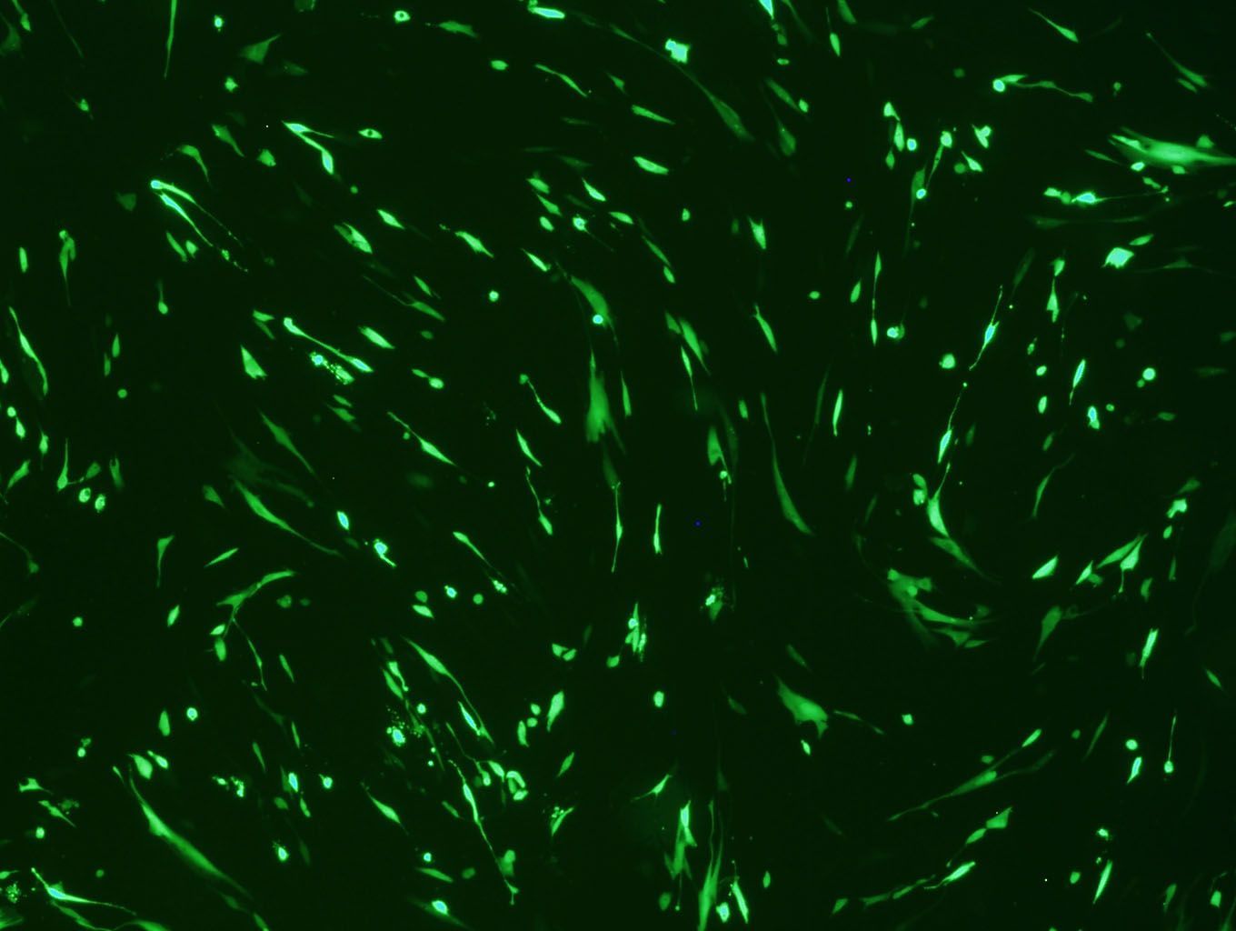 Human Cardiac Fibroblasts (HCF, NHCF-A, NHCF-V, AoAF) Avalanche™ Transfection Reagent, 1.5ml