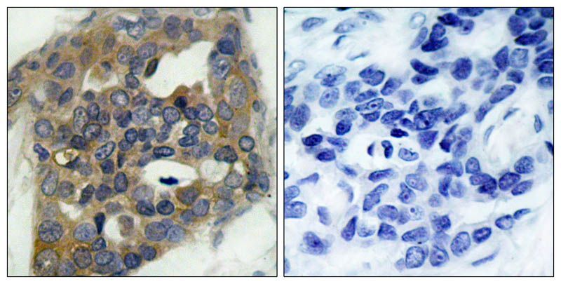 ASK1 (Phospho-Ser966) Rabbit Polyclonal Antibody, 100 ug