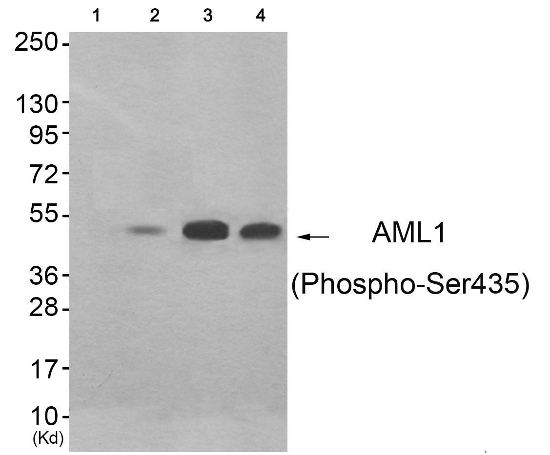 AML1 (Phospho-Ser435) Rabbit Polyclonal Antibody, 100 ug