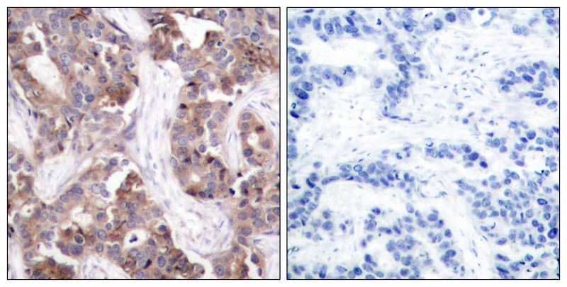 Stathmin 1 (Phospho-Ser25) Rabbit Polyclonal Antibody, 100 ug