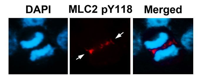 MLC2 (Phospho-Tyr118) Rabbit Polyclonal Antibody, 100 ug