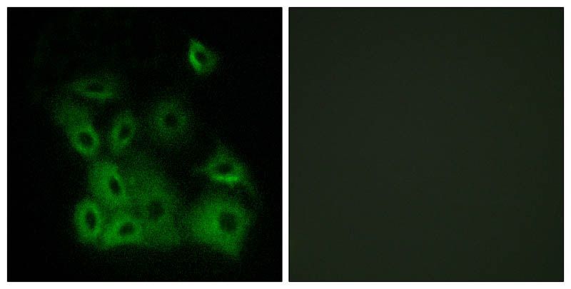 Bax (Phospho-Thr167) Rabbit Polyclonal Antibody, 100 ug