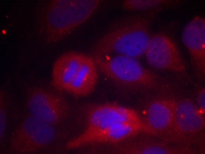 Tyrosine Hydroxylase (Phospho-Ser31) Rabbit Polyclonal Antibody, 100 ug