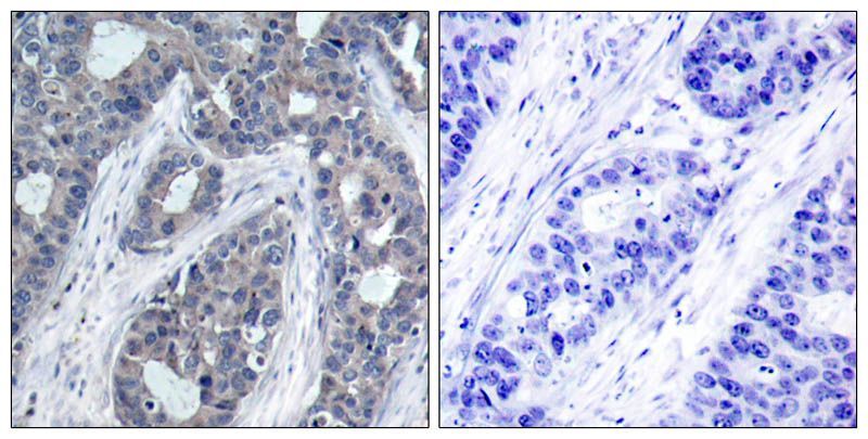 IRS-1 (Phospho-Ser636) Rabbit Polyclonal Antibody, 100 ug