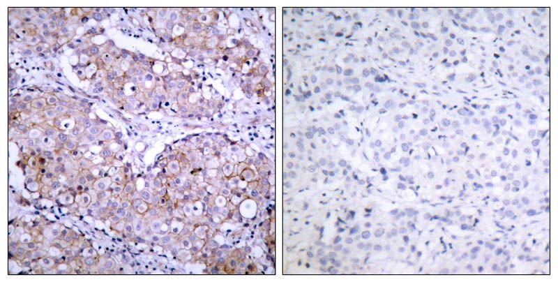 EGFR (Phospho-Ser1070) Rabbit Polyclonal Antibody, 100 ug