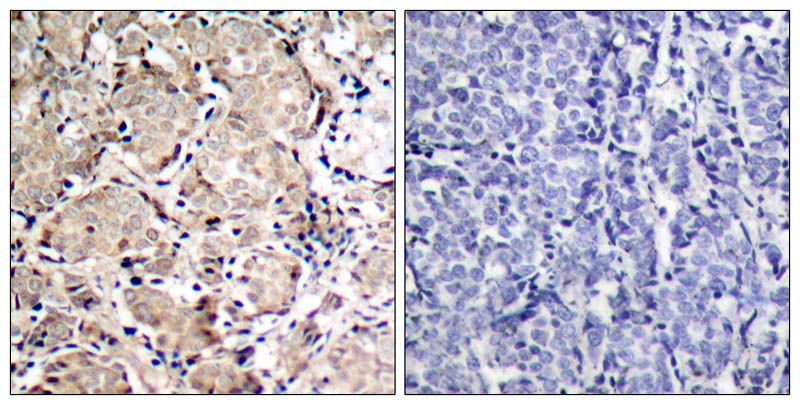 FKHR (Phospho-Ser319) Rabbit Polyclonal Antibody, 100 ug