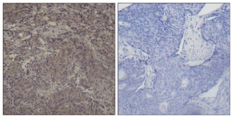 CREB(Phospho-Ser142) Rabbit Polyclonal Antibody, 100 ug