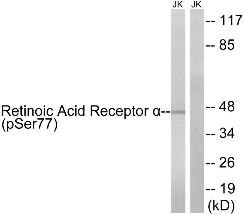Retinoic Acid Receptor α (Phospho-Ser77) Rabbit Polyclonal Antibody, 100 ug
