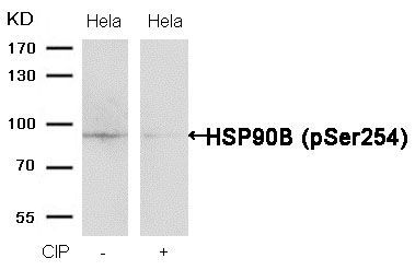 HSP90B (Phospho-Ser254) Rabbit Polyclonal Antibody, 100 ug