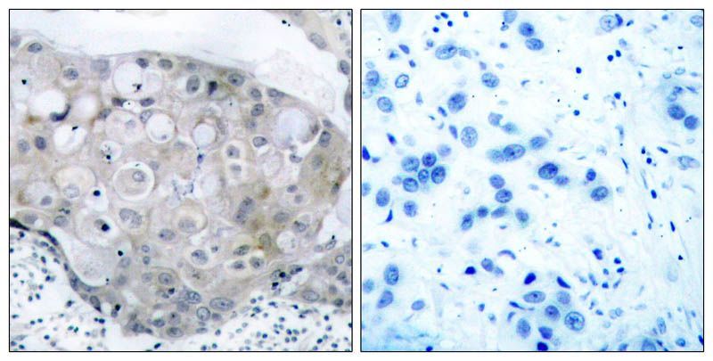 VEGFR2 (Phospho-Tyr951) Rabbit Polyclonal Antibody, 100 ug