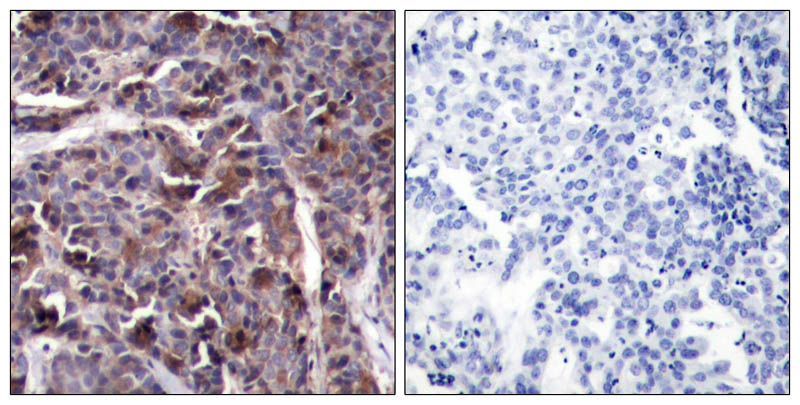 NFκB-p65 (Phospho-Thr505) Rabbit Polyclonal Antibody, 100 ug