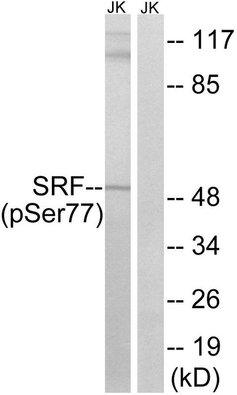 SRF (Phospho-Ser77) Rabbit Polyclonal Antibody, 100 ug