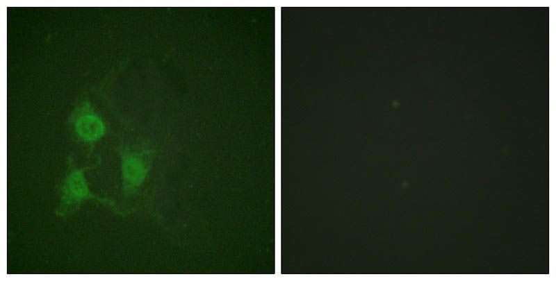 PKA α/β CAT (Phospho-Thr197) Rabbit Polyclonal Antibody, 100 ug