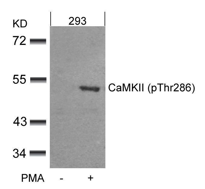 CaMKII (Phospho-Thr286) Rabbit Polyclonal Antibody, 100 ug