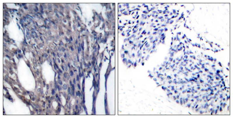 IκB-α (Phospho-Tyr42) Rabbit Polyclonal Antibody, 100 ug