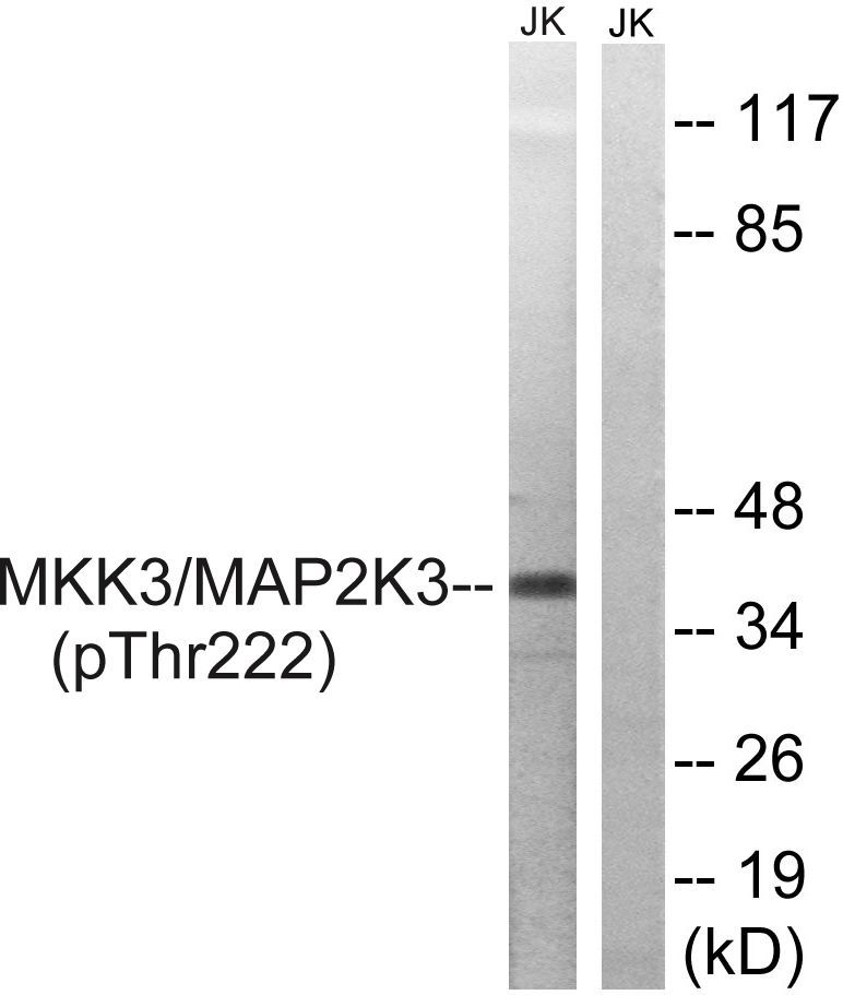 MAP2K3 (Phospho-Thr222) Rabbit Polyclonal Antibody, 100 ug