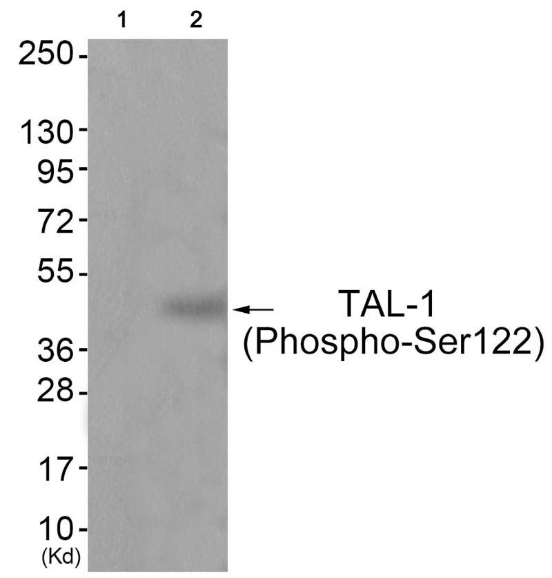 TAL-1 (Phospho-Ser122) Rabbit Polyclonal Antibody, 100 ug