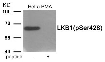LKB1 (Phospho-Ser428) Rabbit Polyclonal Antibody, 100 ug