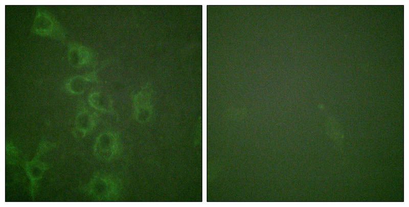 Histamine H1 Receptor (Phospho-Ser398) Rabbit Polyclonal Antibody, 100 ug