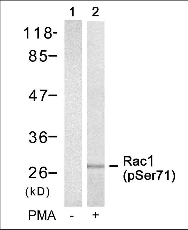 Rac1 (Phospho-Ser71) Rabbit Polyclonal Antibody, 100 ug