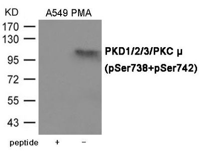PKD1/2/3/PKC μ (Phospho-Ser738/742) Rabbit Polyclonal Antibody, 100 ug