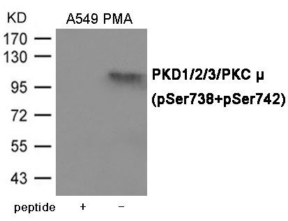 PKD1/2/3/PKC μ (Phospho-Ser738/742) Rabbit Polyclonal Antibody, 100 ug