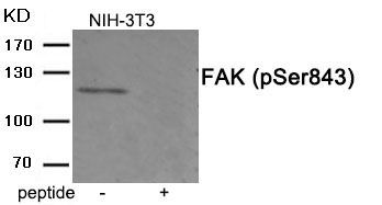 FAK (Phospho-Ser843) Rabbit Polyclonal Antibody, 100 ug